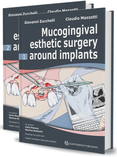 https://dentalmp4.com/wp-content/uploads/2022/12/Mucogingival-Esthetic-Surgery-Around-Implants.png