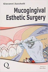 https://www.dentalbooks.org/wp-content/uploads/2019/02/Mucogingival-Esthetic-Surgery-Giovanni-Zucchelli.jpg