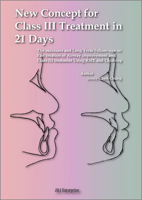 New concept for Class III treatment in 21 days