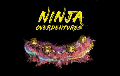 https://dentalmp4.com/wp-content/uploads/2023/04/Ninja-Overdentures.jpg