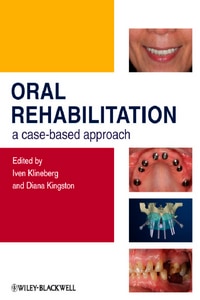 https://www.dentalbooks.org/wp-content/uploads/2019/02/Oral-Rehabilitation-A-Case-Based-Approach.jpg