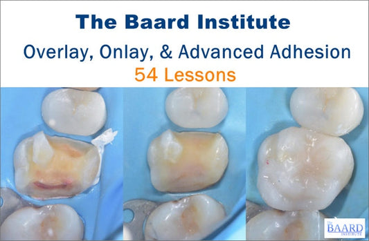 https://dentalmp4.com/wp-content/uploads/2023/07/Overlay-Onlay-Advanced-Adhesion.jpg