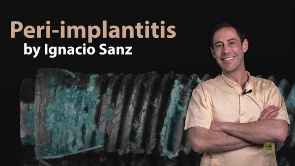 https://dental-books.com/wp-content/uploads/2022/12/Peri-Implantitis_Ignacio-Sanz.jpg