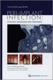 https://www.dentalbooks.org/wp-content/uploads/2019/07/Peri-implant-Infection-Etiology-Diagnosis-and-Treatment-180x270.jpg