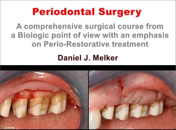 https://dental-books.com/wp-content/uploads/2023/04/Periodontal-Surgery_A-Comprehensive-Surgical-Course.jpg