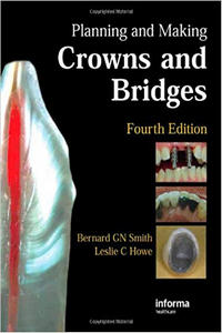 https://www.dentalbooks.org/wp-content/uploads/2019/02/Planning-and-Making-Crowns-and-Bridges-4th-ed.jpg