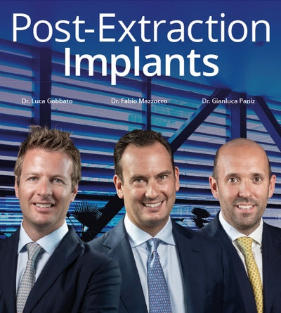 https://dentalmp4.com/wp-content/uploads/2022/08/Post-Extraction-Implants.jpg