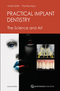 https://www.dentalbooks.org/wp-content/uploads/2019/02/Practical-Implant-Dentistry-The-Science-and-Art-2nd.jpg
