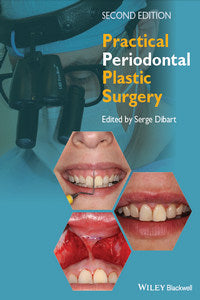 https://www.dentalbooks.org/wp-content/uploads/2019/02/Practical-Periodontal-Plastic-Surgery-2nd-Edition.jpg