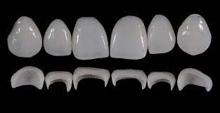 https://dentalmp4.com/wp-content/uploads/2022/08/Prosthetic-Rehabilitation-on-Natural-Teeth.jpg