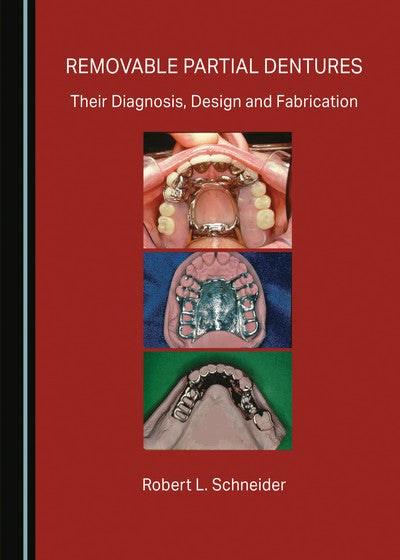 https://dentalmp4.com/wp-content/uploads/2025/02/Removable-Partial-Dentures-Their-Diagnosis-Design-and-Fabrication.jpg