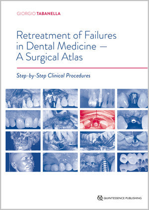 https://dentalmp4.com/wp-content/uploads/2025/01/Retreatment-of-Failures-in-Dental-Medicine-A-Surgical-Atlas.jpg