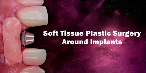 https://dental-books.com/wp-content/uploads/2023/05/Soft-Tissue-Plastic-Surgery-Around-Implants.jpg