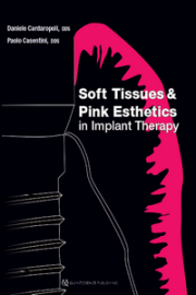 https://www.dentalbooks.org/wp-content/uploads/2019/12/Soft-Tissues-and-Pink-Esthetics-in-Implant-Therapy-180x270.png