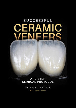 https://dentalmp4.com/wp-content/uploads/2024/07/Successful-Ceramic-Veneers.jpg