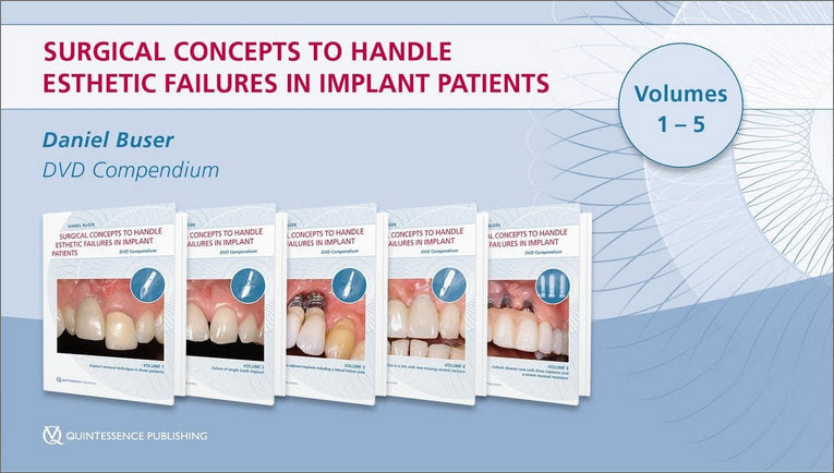https://dentalmp4.com/wp-content/uploads/2022/07/Surgical-concepts-to-handle-esthetic-failures-in-implant-patients.jpg