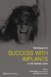 https://www.dentalbooks.org/wp-content/uploads/2019/10/Techniques-for-Success-With-Implants-in-the-Esthetic-Zone-180x270.jpg