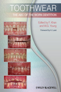 https://dental-library.net/wp-content/uploads/2019/01/Toothwear-The-ABC-of-the-Worn-Dentition.jpg