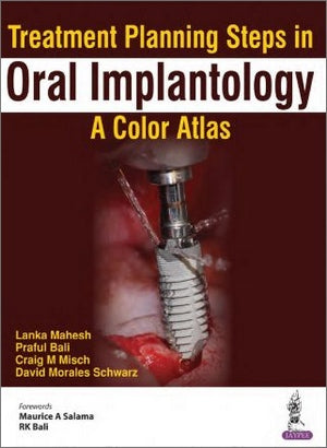 https://dentalmp4.com/wp-content/uploads/2023/02/Treatment-Planning-Steps-in-Oral-Implantology-A-Color-Atlas.jpg