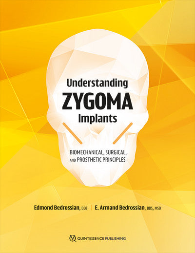 https://dentalmp4.com/wp-content/uploads/2025/12/Understanding-Zygoma-Implants.jpg