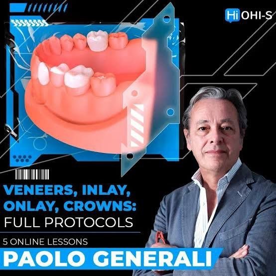 https://dentalmp4.com/wp-content/uploads/2023/08/Veneers-Inlay-Onlay-Crowns-Full-Protocols.jpg
