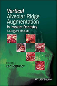 https://www.dentalbooks.org/wp-content/uploads/2019/02/Vertical-Alveolar-Ridge-Augmentation-in-Implant-Dentistry.jpg