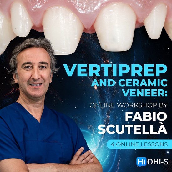 https://dentalmp4.com/wp-content/uploads/2023/08/Vertical-Preparation-and-Ceramic-Veneers.jpg
