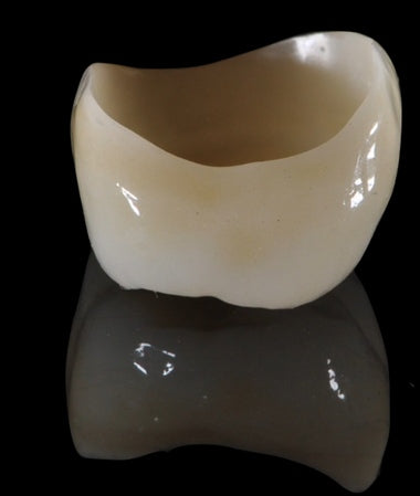 https://dentalmp4.com/wp-content/uploads/2022/06/Vertical-preparation-protocols-4.jpg