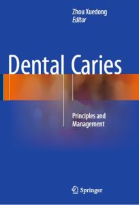 https://dental-library.net/wp-content/uploads/2019/01/dental-caries.jpg