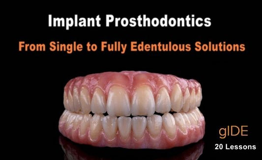 Implant Prosthodontics – From Single to Fully Edentulous Solutions