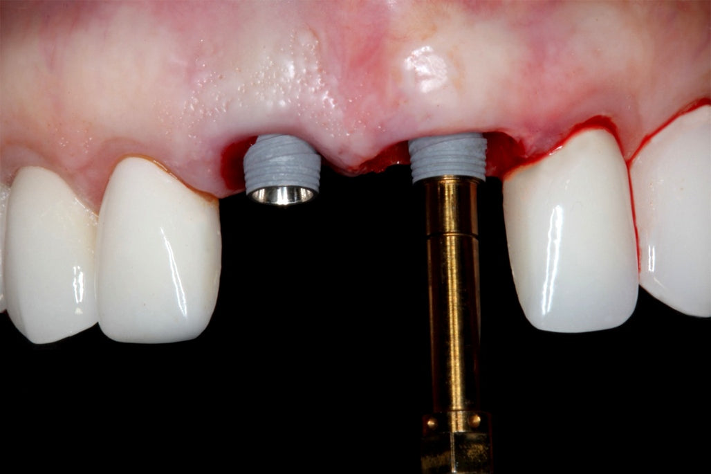 https://dentalmp4.com/wp-content/uploads/2022/06/online-residency-program-a-z-in-implant-dentistry-2022.jpg